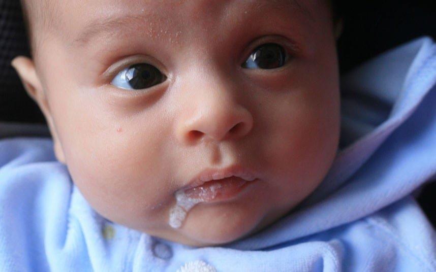 Tình trạng nôn trớ sữa ở trẻ sơ sinh do hệ tiêu hóa còn non yếu